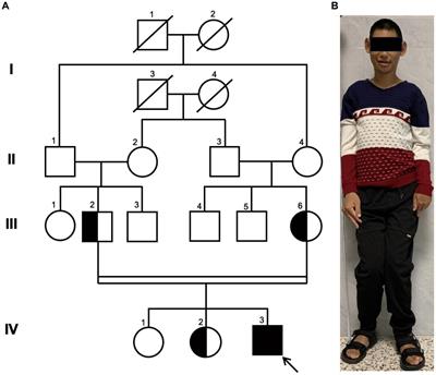 Autosomal recessive primary microcephaly type 2 associated with a novel WDR62 splicing variant that disrupts the expression of the functional transcript